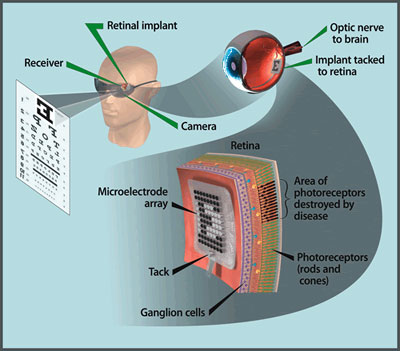 Artificial Retina Diagram